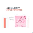 Sie sehen eine Packung Avene Antirougeurs Rosamed Konzentrat 30ml, Produktbild: 15 Avene Antirougeurs Rosamed Konzentrat 30ml, A-Nr.: 5862025 - 15