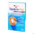Sie sehen eine Packung 3M Tegaderm + Pad 5 x 7 cm, 5 Stück, Produktbild: 04 3M Tegaderm + Pad 5 x 7 cm, 5 Stück, A-Nr.: 2022508 - 04